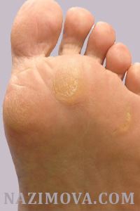 usl-laser-mozoly.jpg usl-laser-mozoly.jpg